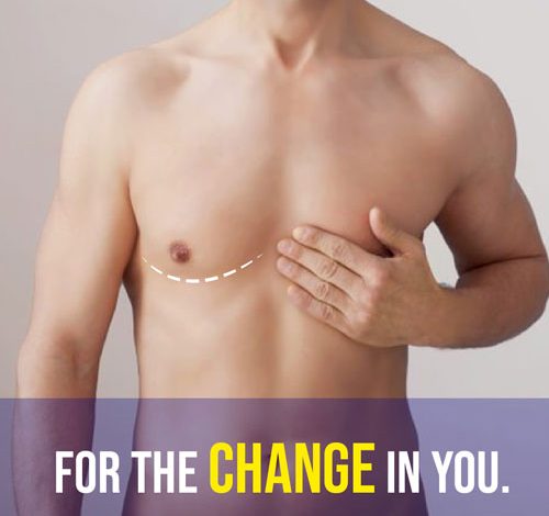 gynecomastia surgeon in Chandigarh