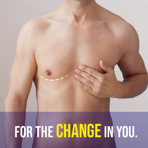 gynecomastia surgeon in Chandigarh