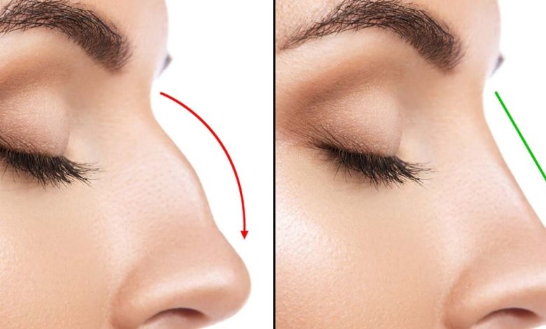 rhinoplasty cost in Haryana