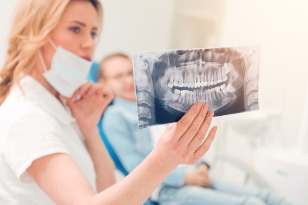 Wisdom Teeth And Orthodontic Treatments