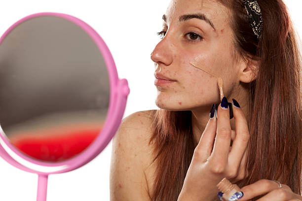 Which is the Best Primer For Acne Scars and Large Pores?