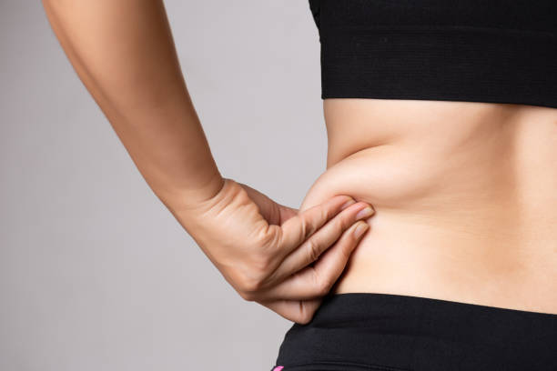 Liposuction in Chandigarh