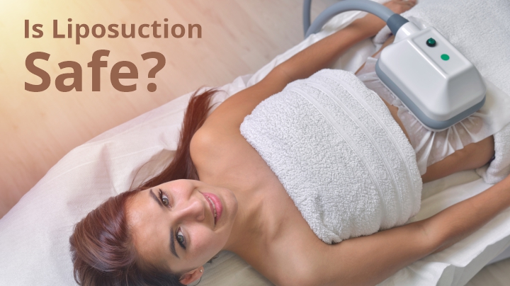 liposuction side effects