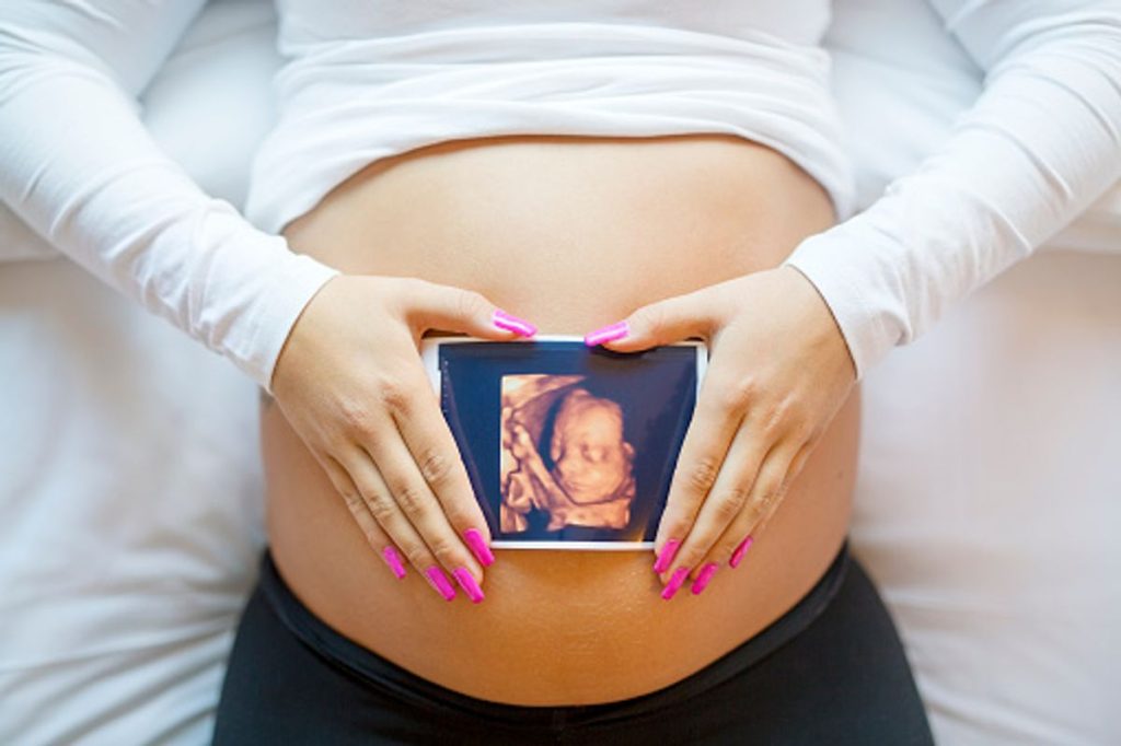 3d sonograms during pregnancy