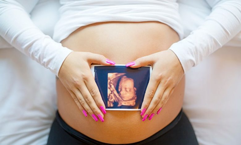 3d sonograms during pregnancy